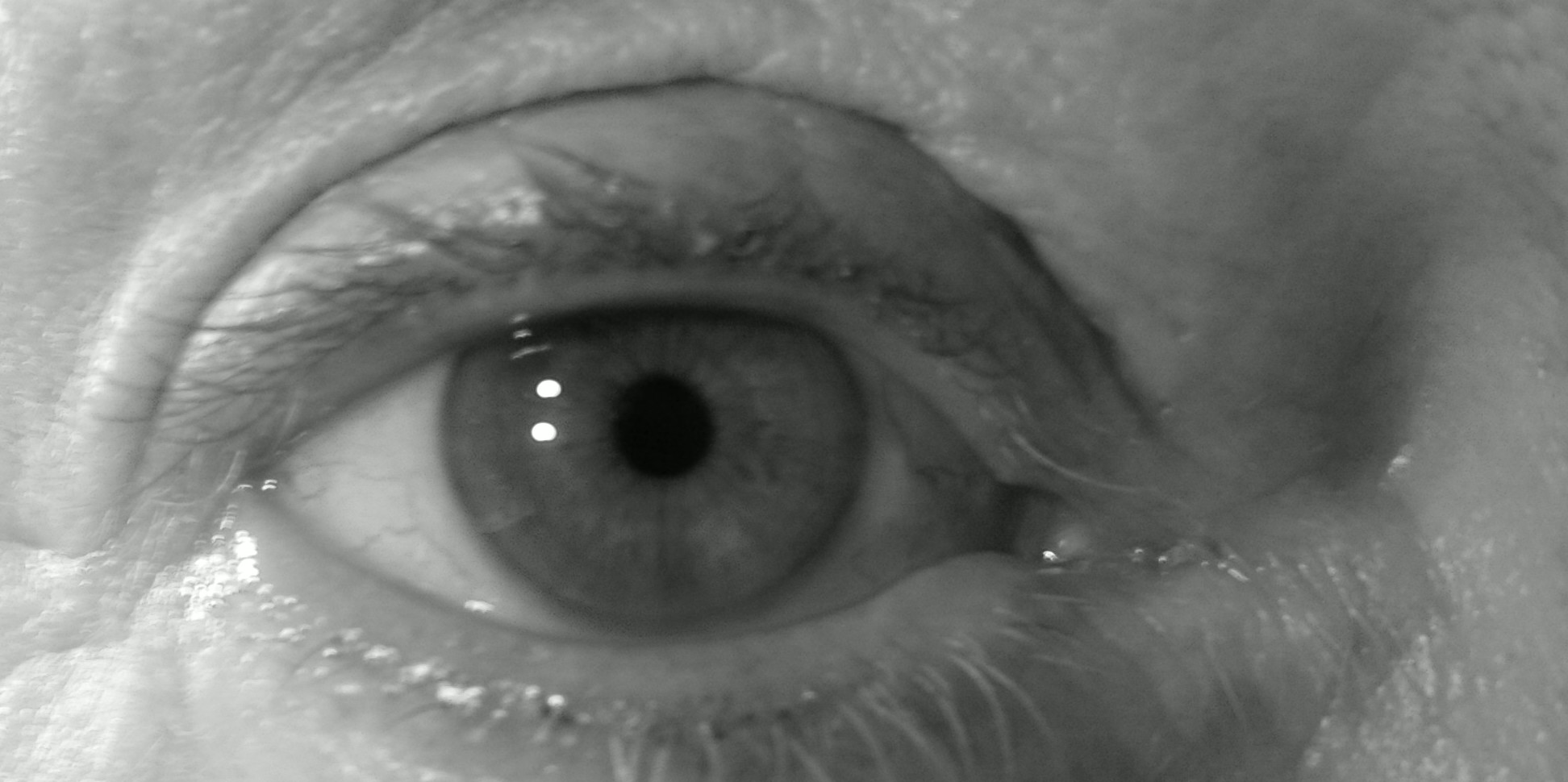 Auge beim Augenarzt