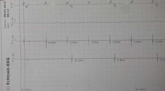 EKG des Kardiologen